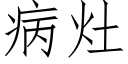 病灶 (仿宋矢量字库)